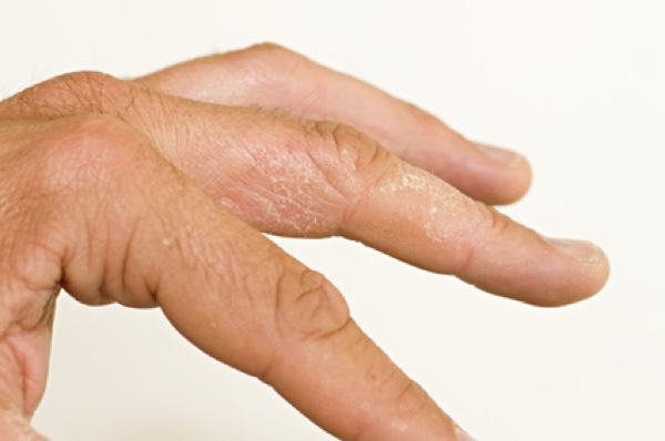 Hand Operation in Berlin bei Dr. Klauser. (Bildquelle:©casi - Fotolia.com) Hand Operation in Berlin bei Dr. Klauser. (Bildquelle:©casi - Fotolia.com)