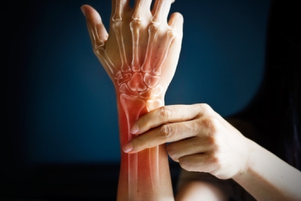 Eine Operation ist bei Arthrose nur in schweren Fällen nötig. (Bildquelle:©ipopba - Fotolia.com)