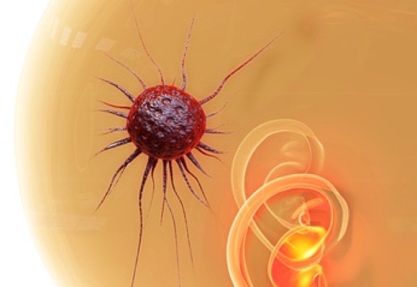 Professor Dr. Veit Braun operiert am Diakonie Klinikum Siegen. (Bildquelle:©fotoliaxrender - Fotolia Professor Dr. Veit Braun operiert am Diakonie Klinikum Siegen. (Bildquelle:©fotoliaxrender - Fotolia