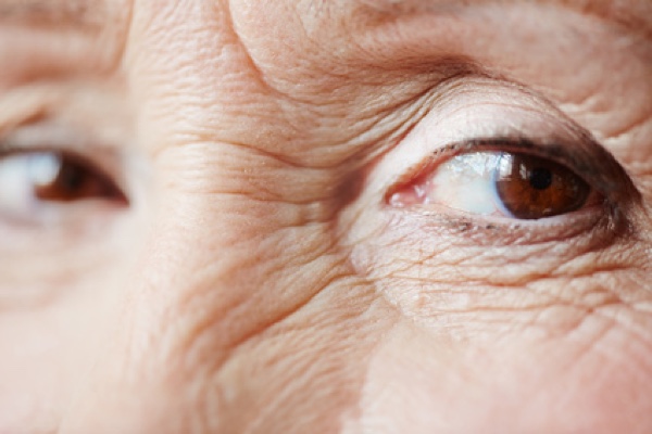 Trübung der Augenlinse kann in ca. 20 Minuten Vergangenheit sein. (Bildquelle:©pressmaster - Fotolia