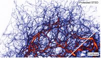 Protected STED microscopy provides images with unprecedented contrast and dynamic range. Protected STED microscopy provides images with unprecedented contrast and dynamic range.