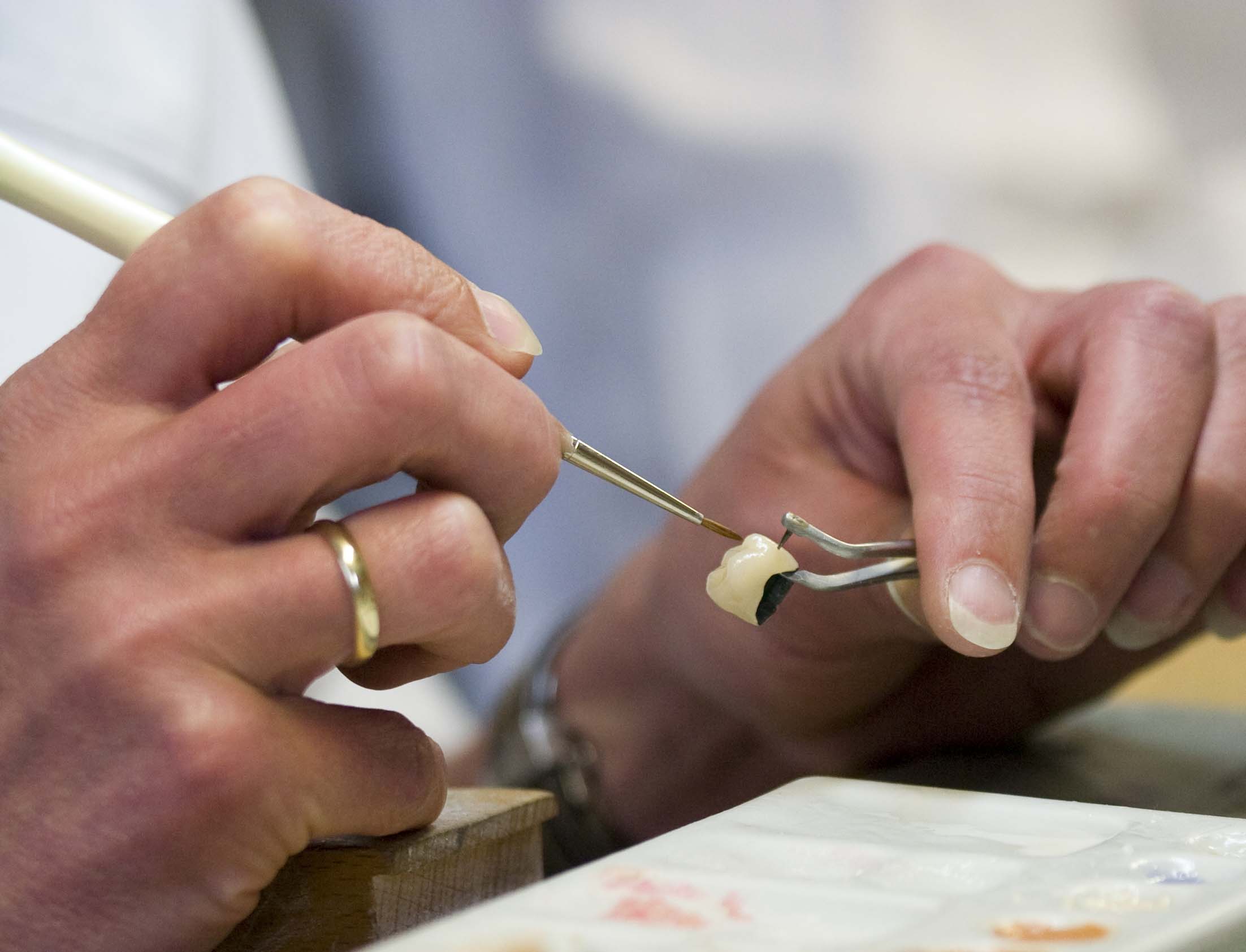 Günstiger Zahnersatz aus deutschem Dentallabor MAXiDENT: Best-Price-Dent rät zum Kostenvergleich Günstiger Zahnersatz aus deutschem Dentallabor MAXiDENT: Best-Price-Dent rät zum Kostenvergleich