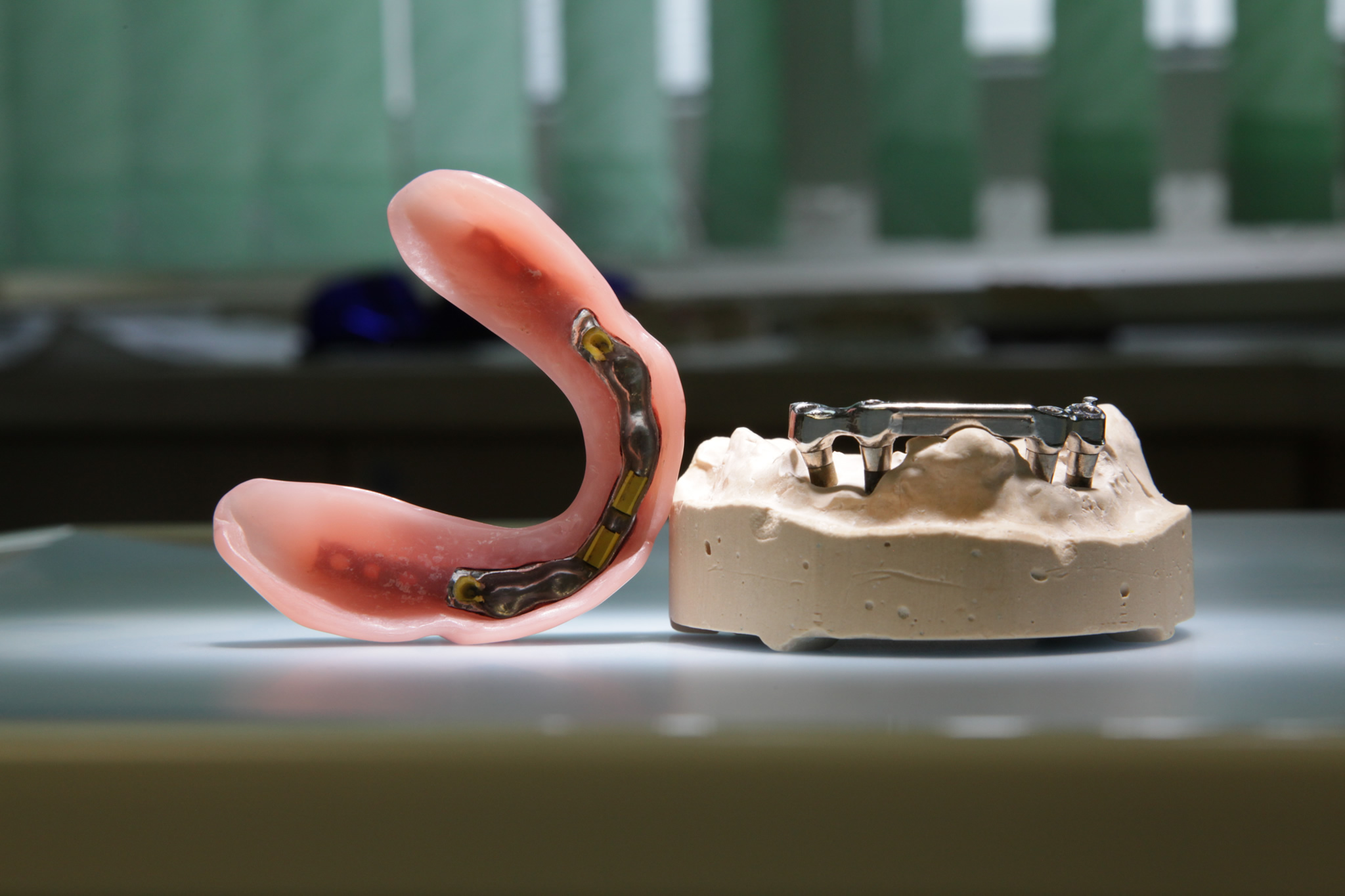 (Bildquelle: Gelencsér Dental Zahnklinik, Ungarn) (Bildquelle: Gelencsér Dental Zahnklinik, Ungarn)