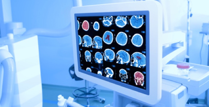 Mit neuester Technik in der Neurochirurgie in Siegen. (Bildquelle:©sudok1 - Fotolia.com) Mit neuester Technik in der Neurochirurgie in Siegen. (Bildquelle:©sudok1 - Fotolia.com)