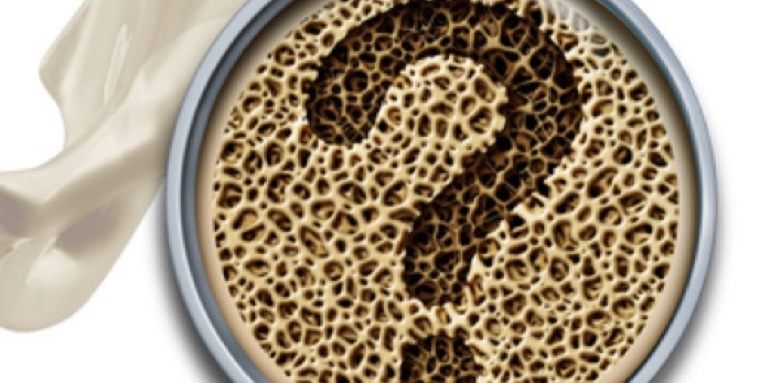 Experte aus Tettnang informiertüber Osteoporose. (Bildquelle:©freshidea - Fotolia.com) Experte aus Tettnang informiertüber Osteoporose. (Bildquelle:©freshidea - Fotolia.com)