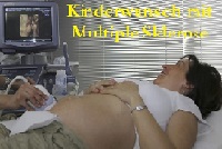 Kinderwunsch mit Multiple Sklerose Kinderwunsch mit Multiple Sklerose
