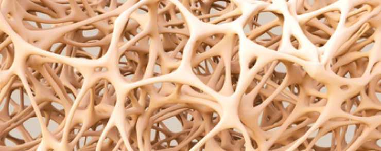 Endokrinologe aus Mainz rät zur Vorsorgeuntersuchung: Osteoporose. (Bildquelle:©adimas - Fotolia.com Endokrinologe aus Mainz rät zur Vorsorgeuntersuchung: Osteoporose. (Bildquelle:©adimas - Fotolia.com