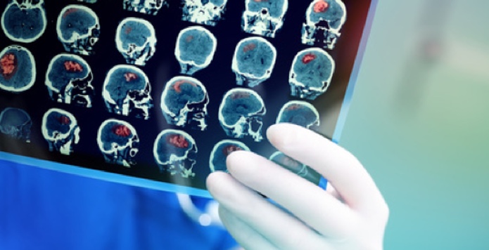 Behandlung im Klinikum Siegen (Raum Köln / Bonn). (Bildquelle:©sudok1 - Fotolia.com) Behandlung im Klinikum Siegen (Raum Köln / Bonn). (Bildquelle:©sudok1 - Fotolia.com)