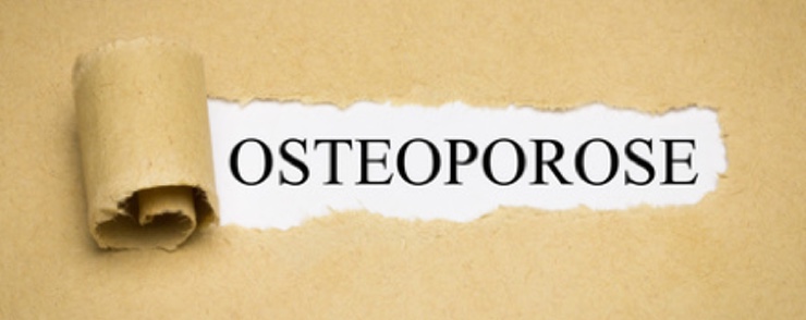 Knochen brüchig? Osteoporose? (Bildquelle:©magele-picture - Fotolia.com) Knochen brüchig? Osteoporose? (Bildquelle:©magele-picture - Fotolia.com)