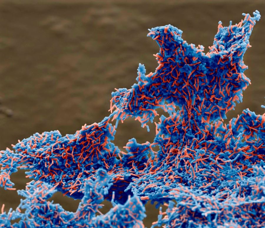 Die Co-Aggregation von Pylopass (blau) mit Helicobacter pylori (rot), 1800-fach vergrößert. (Bildque