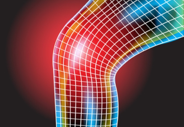 Hilfe durch Hyaluronsäure beim Orthopäden in Heidelberg. (Bildquelle:©best_shop - Fotolia.com)