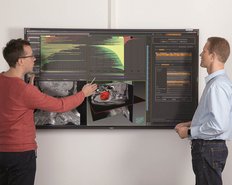 [M] Fraunhofer IGD Forscher arbeiten an einem Verfahren, dass Erfahrungswerte der Ärzte, Bilddaten u