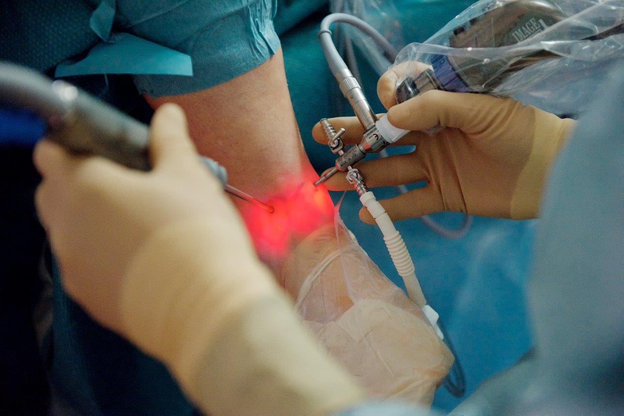 Arthroskopie: minimalinvasiv ins Innere der Gelenke