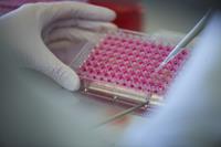 DiagNeeds erfasst Klinikbedarf zur Entwicklung neuer Diagnosetests. © Bjørn Jansen/trenzyme GmbH DiagNeeds erfasst Klinikbedarf zur Entwicklung neuer Diagnosetests. © Bjørn Jansen/trenzyme GmbH