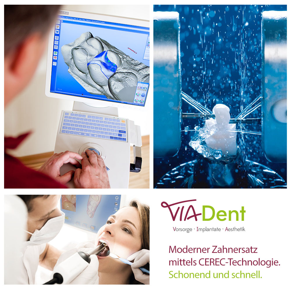 Zahnersatz mittels moderner digitaler CEREC-Technologie Zahnersatz mittels moderner digitaler CEREC-Technologie
