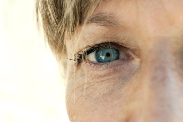 Erhöhte Blendungsempfindlichkeit? Grauer Star? (Bildquelle:©lpictures - Fotolia.com)