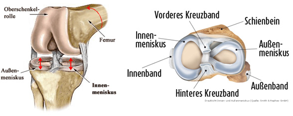 Ansicht Meniskus Ansicht Meniskus