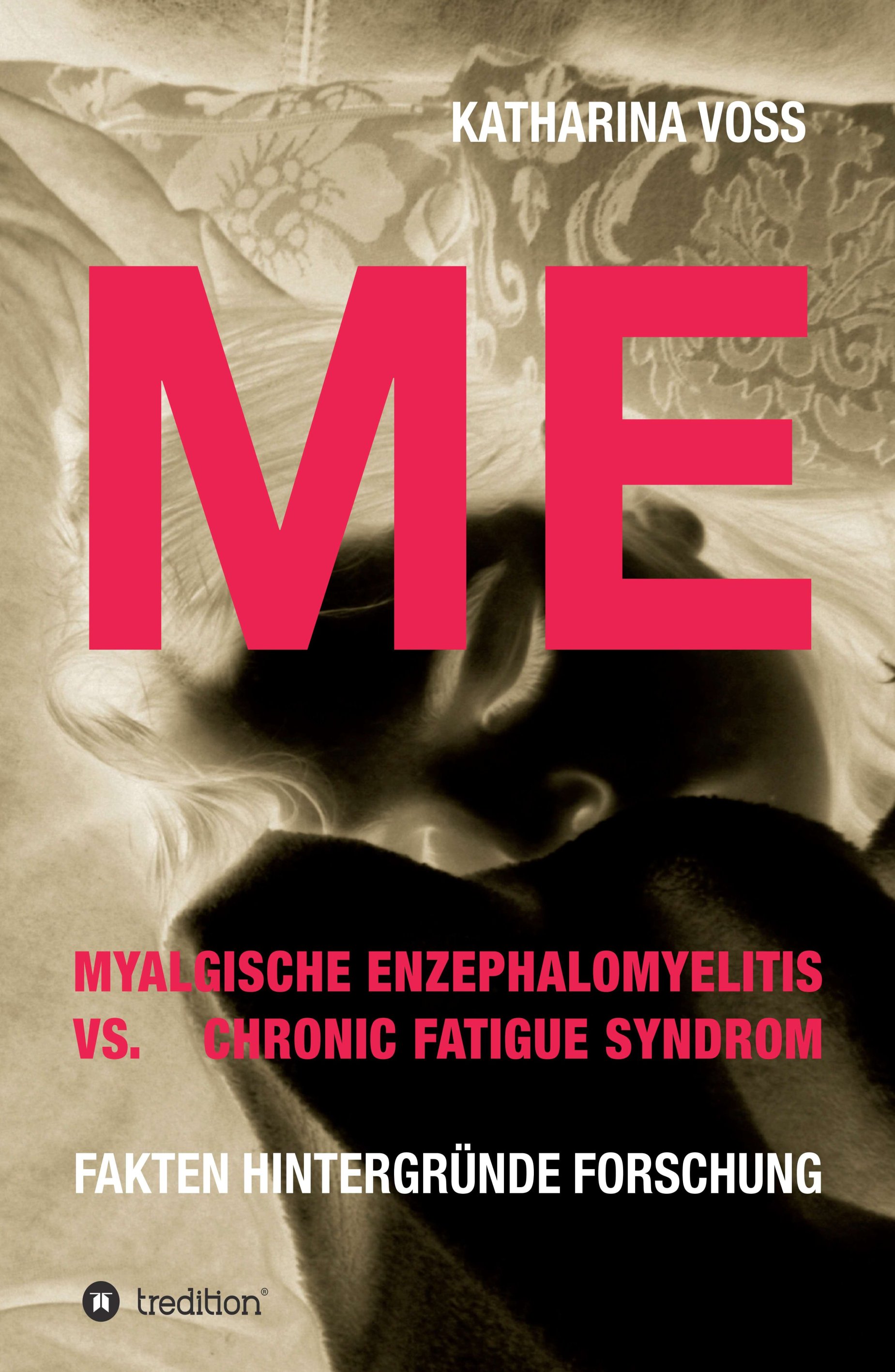 ME - Myalgische Enzephalomyelitis vs. Chronic Fatigue Syndrom ME - Myalgische Enzephalomyelitis vs. Chronic Fatigue Syndrom