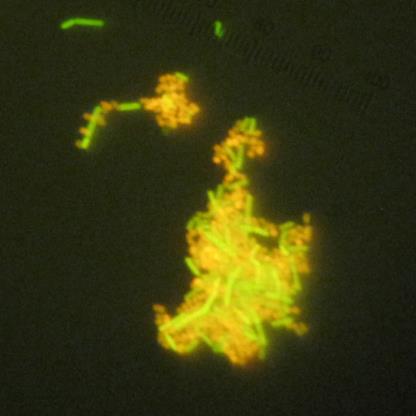 Fluoreszenzmikroskopische Aufnahme: Der Wirkstoff salvans (grün) bindet den Erkältungs-Keim (orange) Fluoreszenzmikroskopische Aufnahme: Der Wirkstoff salvans (grün) bindet den Erkältungs-Keim (orange)
