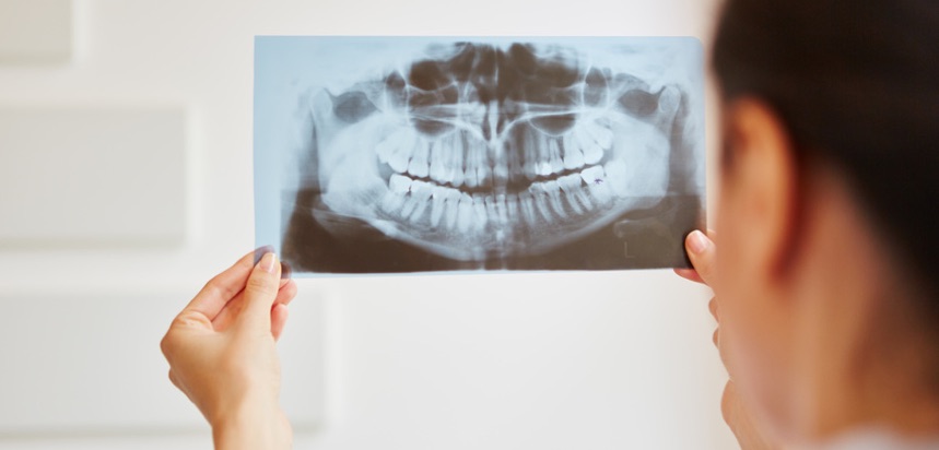 Zahnersatz ist die optimale Lösung für Zahnverlust. (Bildquelle:©Robert Kneschke?Fotolia.com)