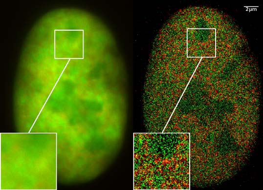 Super Resolution Mikroskopie einer Knochenkrebszelle (Cremer Lab)