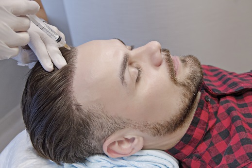 PRP Behandlung - Elithairtransplant