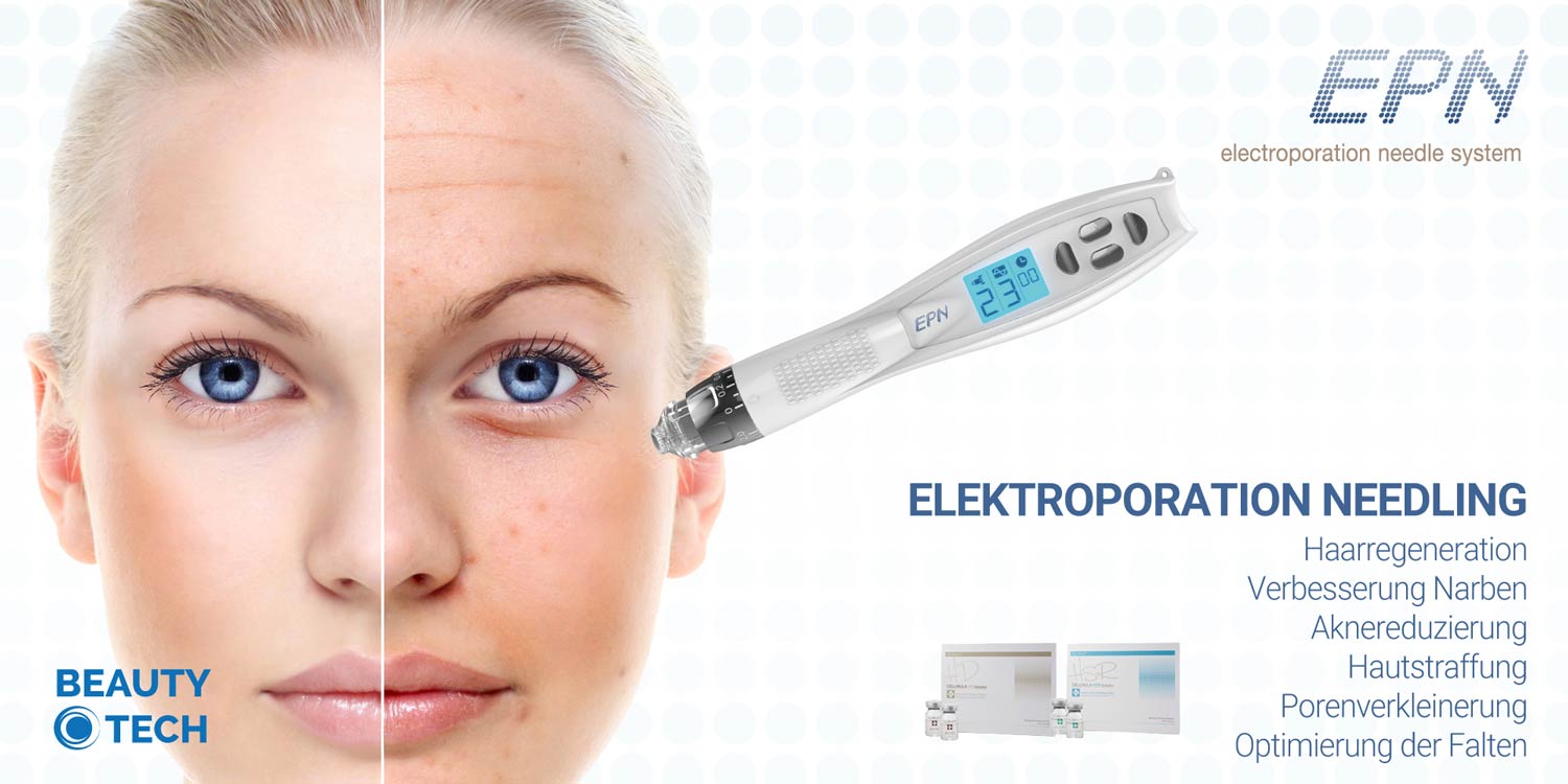 EPN Microneedling EPN Microneedling