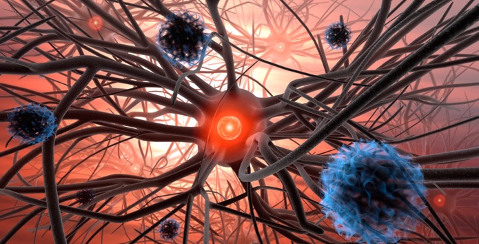 Modernste Technik wird bei einer Hirntumor Operation benötigt. (Bildquelle:©psdesign1?Fotolia) Modernste Technik wird bei einer Hirntumor Operation benötigt. (Bildquelle:©psdesign1?Fotolia)