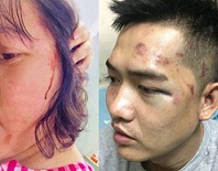 Bloggerin Pham Doan Trang (Bild links) und Sänger Nguyen Tin nach dem Angriff der Polizei