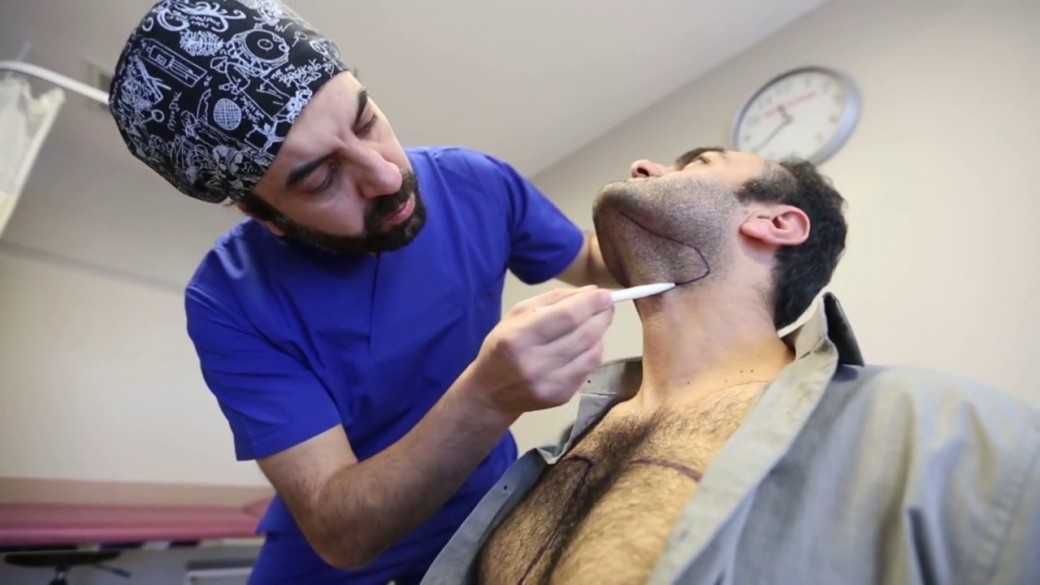 Dr.Cinik - Vorbereitung der DHI Haartransplantation