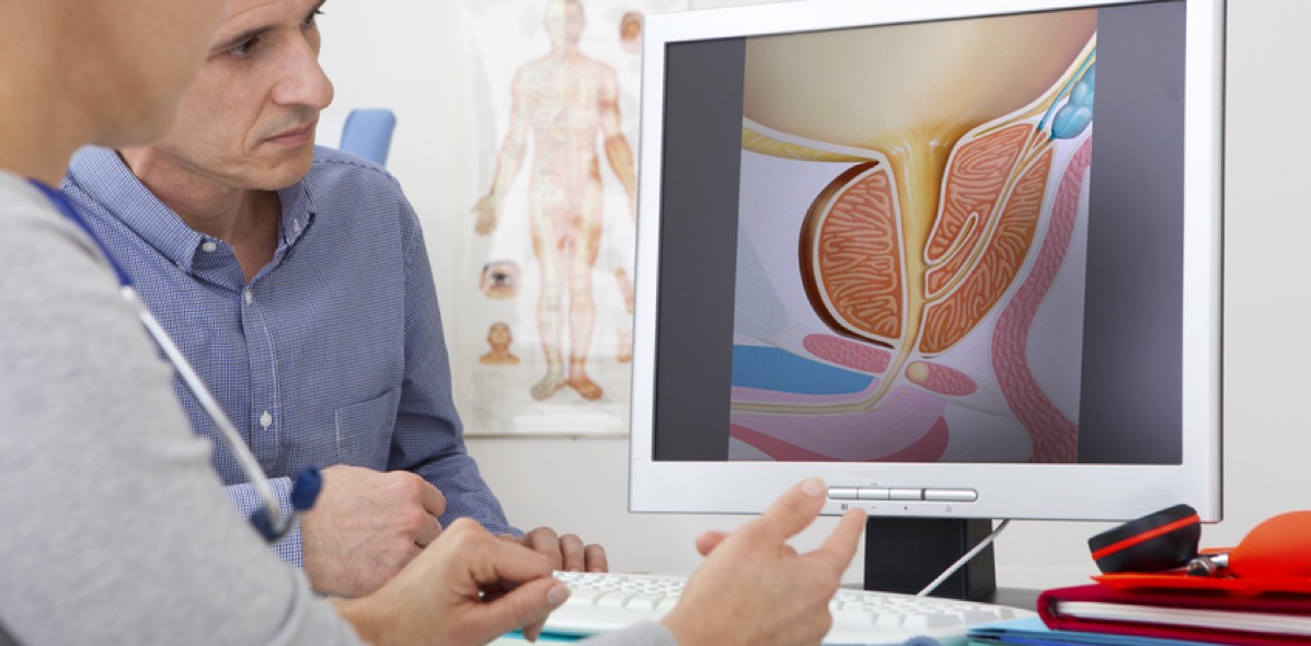 Ultraschall und MRT Einsatz bei der Prostata Behandlung. (Bildquelle:©RFBSIP?Fotolia)