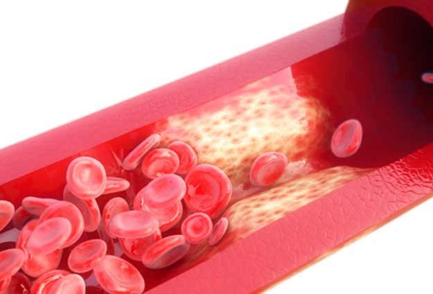Aorta: Größtes Blutgefäßim Menschen. (Bildquelle:©crevis?Fotolia) Aorta: Größtes Blutgefäßim Menschen. (Bildquelle:©crevis?Fotolia)