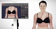 Psoriasis-Dokumentation für Ärzte