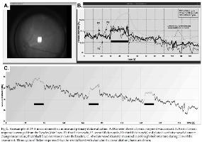 Retinale Gefäßanalyse nun erstmals auch an der Maus (© Imedos Systems GmbH)
