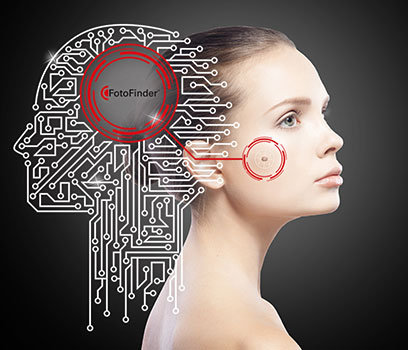 Artificial Intelligence in skin cancer detection. Artificial Intelligence in skin cancer detection.