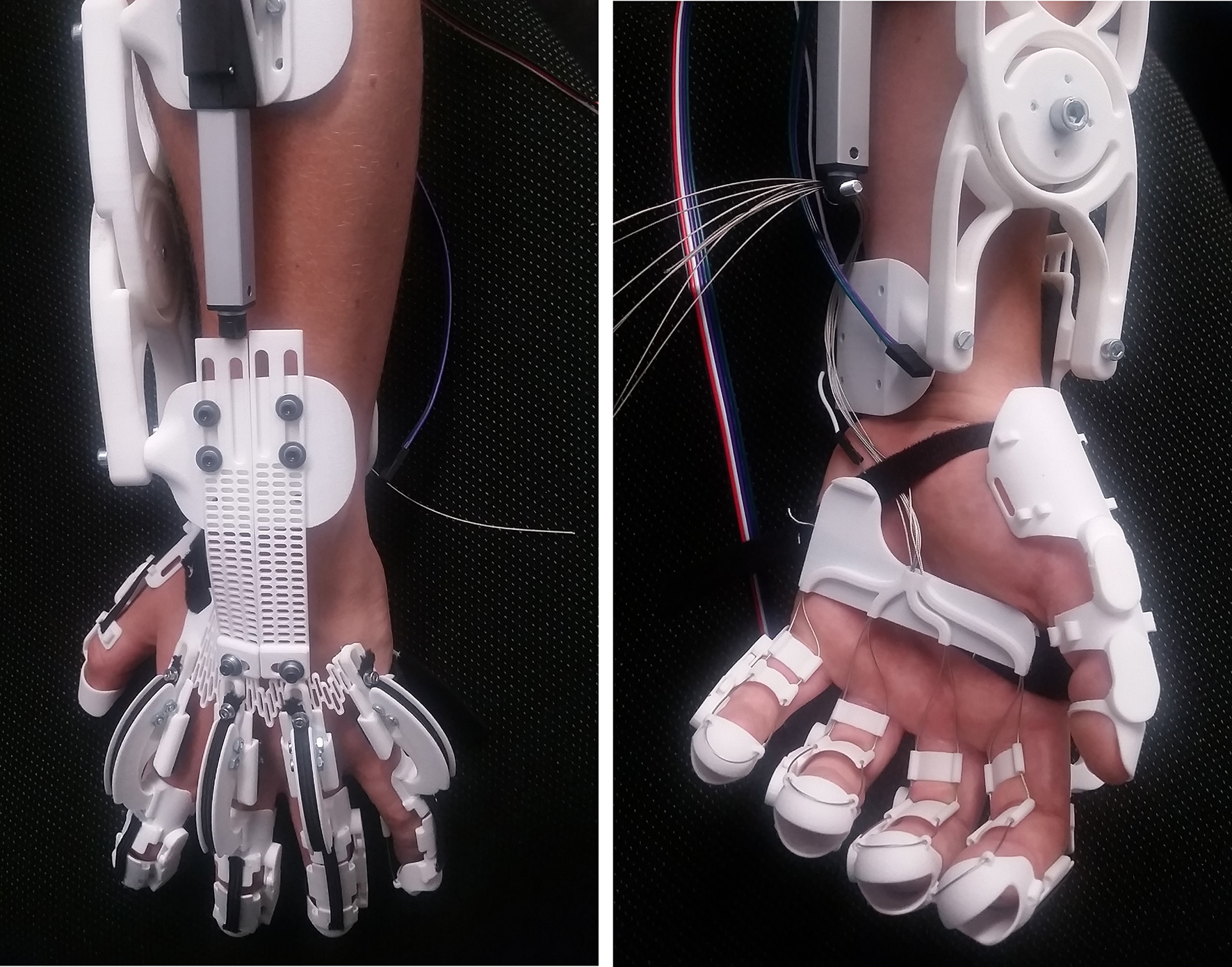 Mit dem Hand-Exoskelett entwickelt wird die Greif-Fähigkeit einer gelähmten Hand wiederhergestellt Mit dem Hand-Exoskelett entwickelt wird die Greif-Fähigkeit einer gelähmten Hand wiederhergestellt