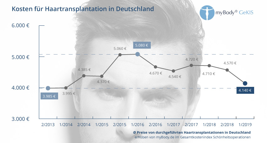 Preisentwicklung für Haartransplantationen in Deutschland Preisentwicklung für Haartransplantationen in Deutschland