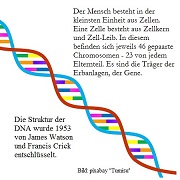 Drei Exemplare des Chromosoms Nummer 21