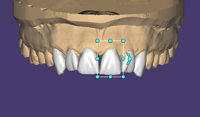 Smile Creator, Bild: exocad GmbH Smile Creator, Bild: exocad GmbH