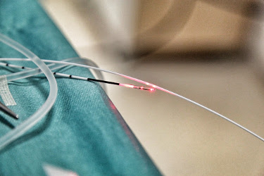 ELVeS®Radial®2ring-Faser der biolitec®(Bildquelle: biolitec®) ELVeS®Radial®2ring-Faser der biolitec®(Bildquelle: biolitec®)