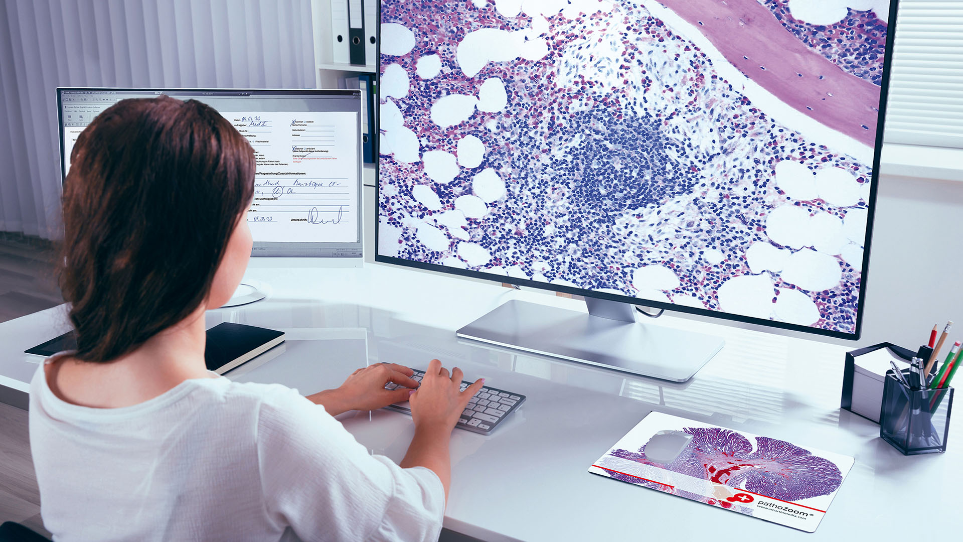 Mit PathoZoom können Pathologen ab sofort Zuhause am Schreibtisch ihre Diagnosen abgeben. Mit PathoZoom können Pathologen ab sofort Zuhause am Schreibtisch ihre Diagnosen abgeben.