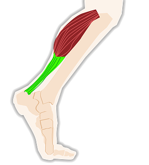 Häufig ist die Achilles-Sehneüberlastet (Bildquelle: Pixabay)