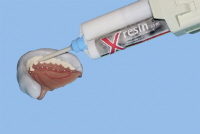 x-resin von bredent wird in den Vorwall eingespritzt. x-resin von bredent wird in den Vorwall eingespritzt.