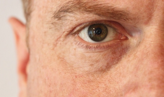 Augenärzte hoffen auf die Entwicklung von Augentropfen mit Cannabis Wirkstoffen gegen trockene Augen Augenärzte hoffen auf die Entwicklung von Augentropfen mit Cannabis Wirkstoffen gegen trockene Augen
