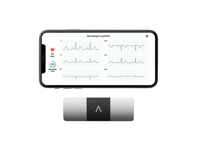 Produktbild KardiaMobile 6L mit Smartphone