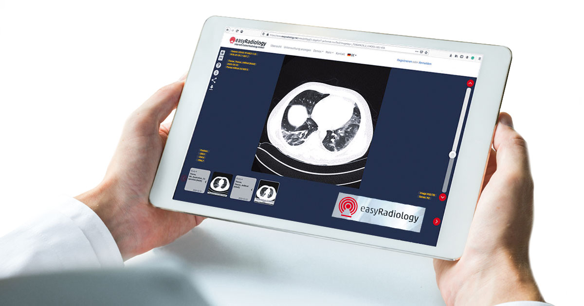 Mit EasyRadiology können Patienten und Zuweiser die Röntgenbilder sofort betrachten. Mit EasyRadiology können Patienten und Zuweiser die Röntgenbilder sofort betrachten.