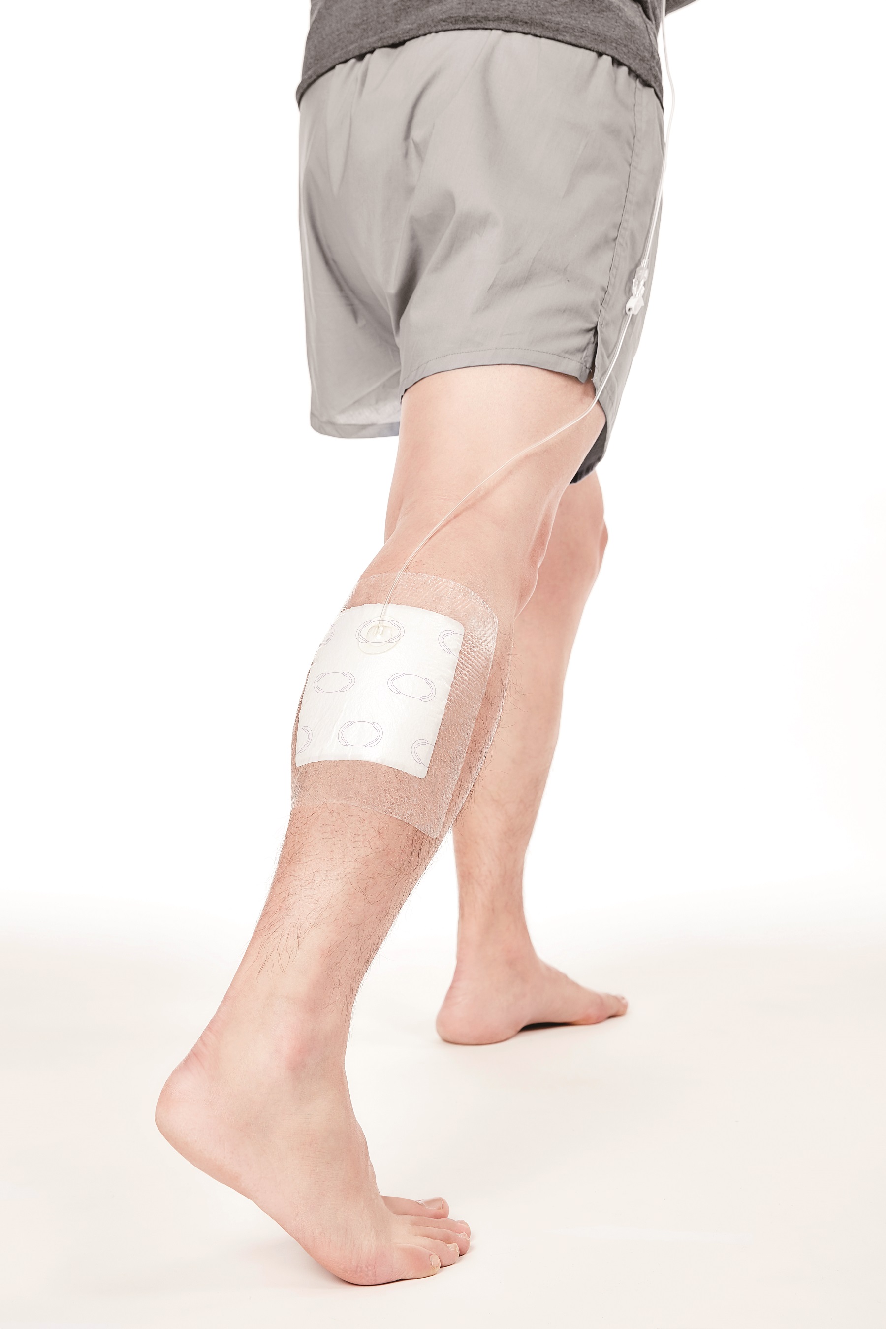 Neues tragbares Vakuumsystem erleichtert Wundheilung (Bildquelle: Anscare, BenQ Materials)