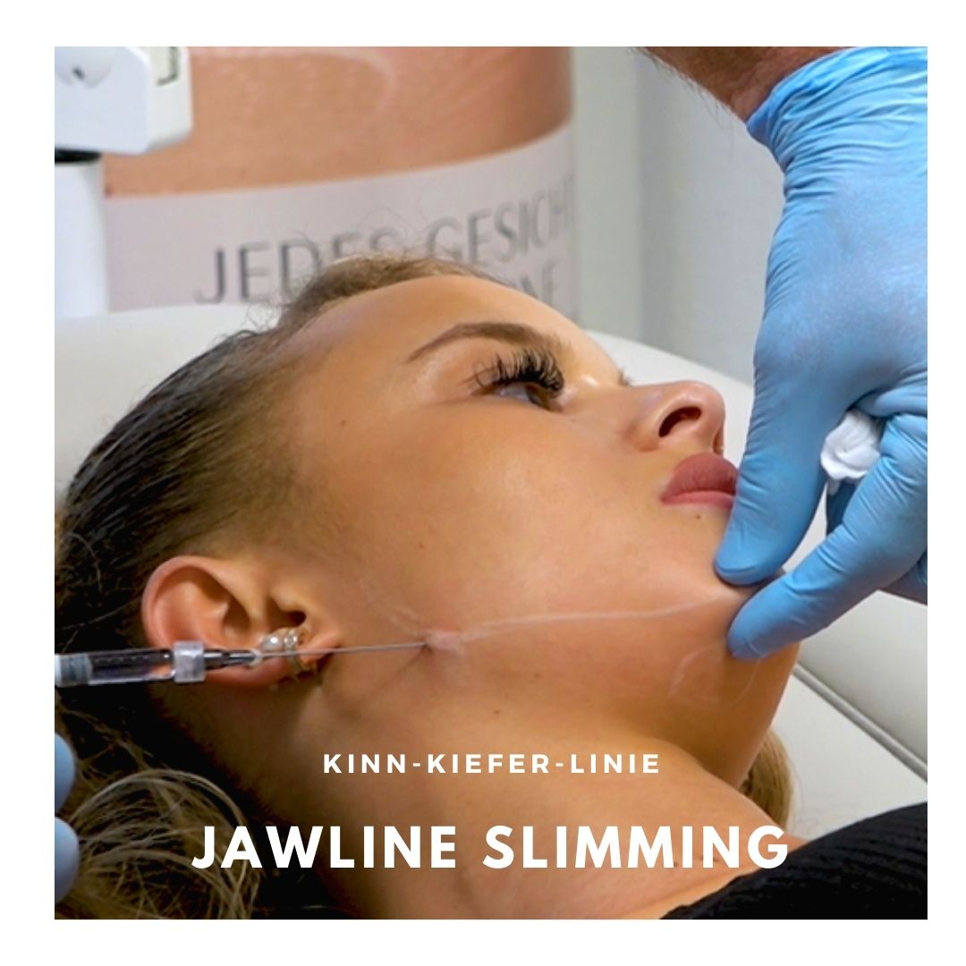 Unterspritzung der Jawline