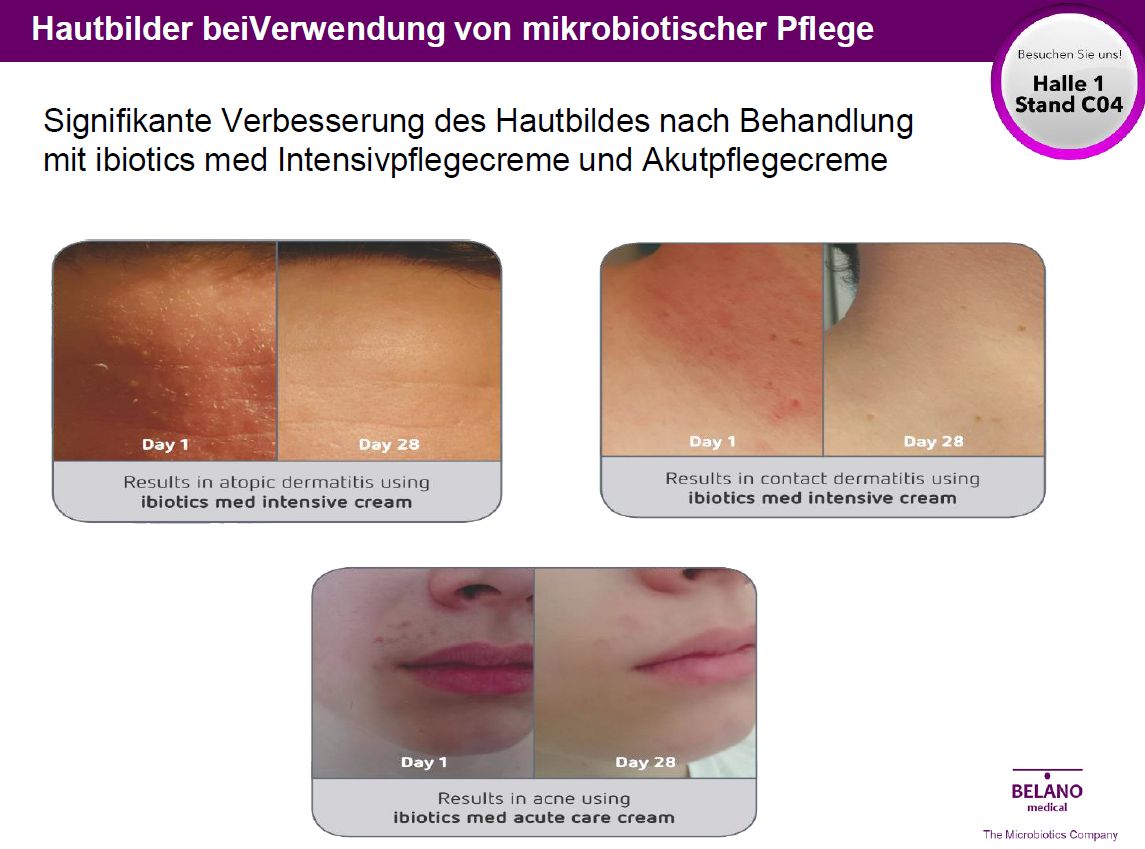 Ausschnitt aus der Präsentation von Prof. Dr. Christine Lang (TU Berlin), Vorstand BELANO medical AG