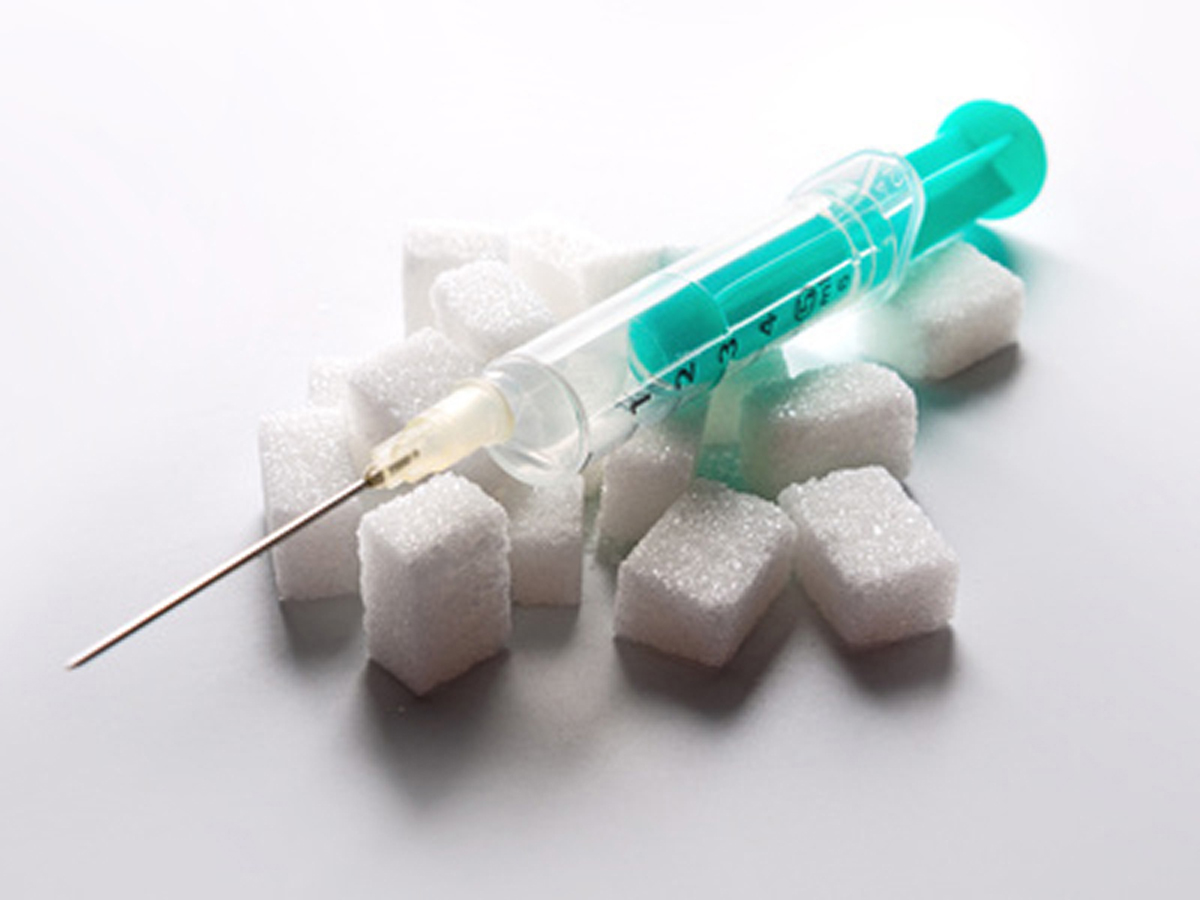 Zusammenhang zwischen Diabetes und Parodontose Zusammenhang zwischen Diabetes und Parodontose